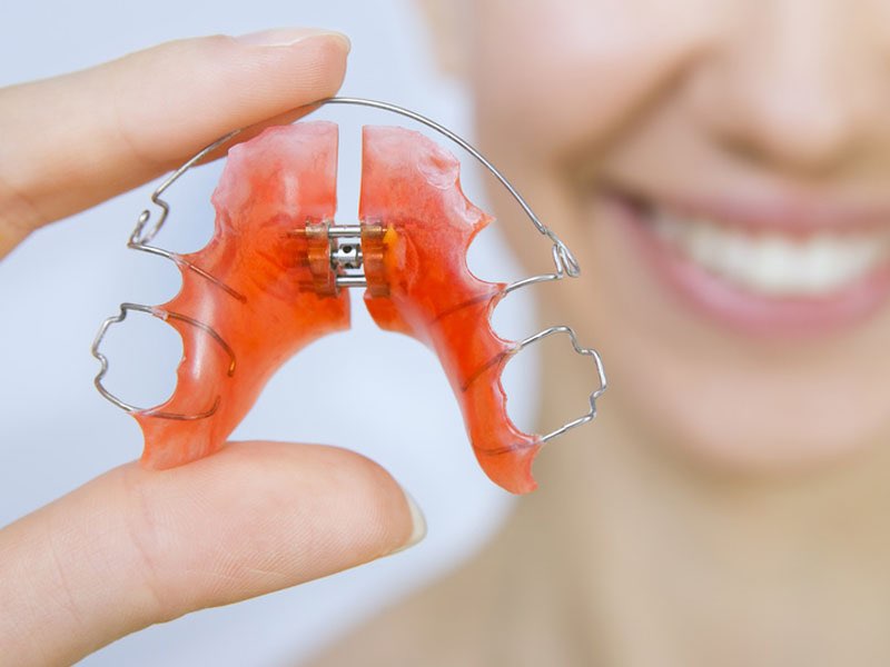 Athens Orthodontics - Dr. Κωνσταντίνος Τζαμάλας - Ορθοδοντικός Αθήνα